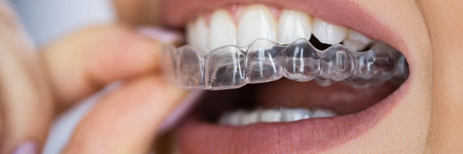 Planejamento digital em Odontologia